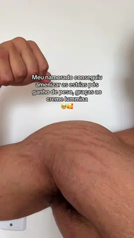 Creme lummi não funciona? Olha só esse resultado 🥹🤌🏻 #vaiprafy #mulheres #dicasdebeleza 