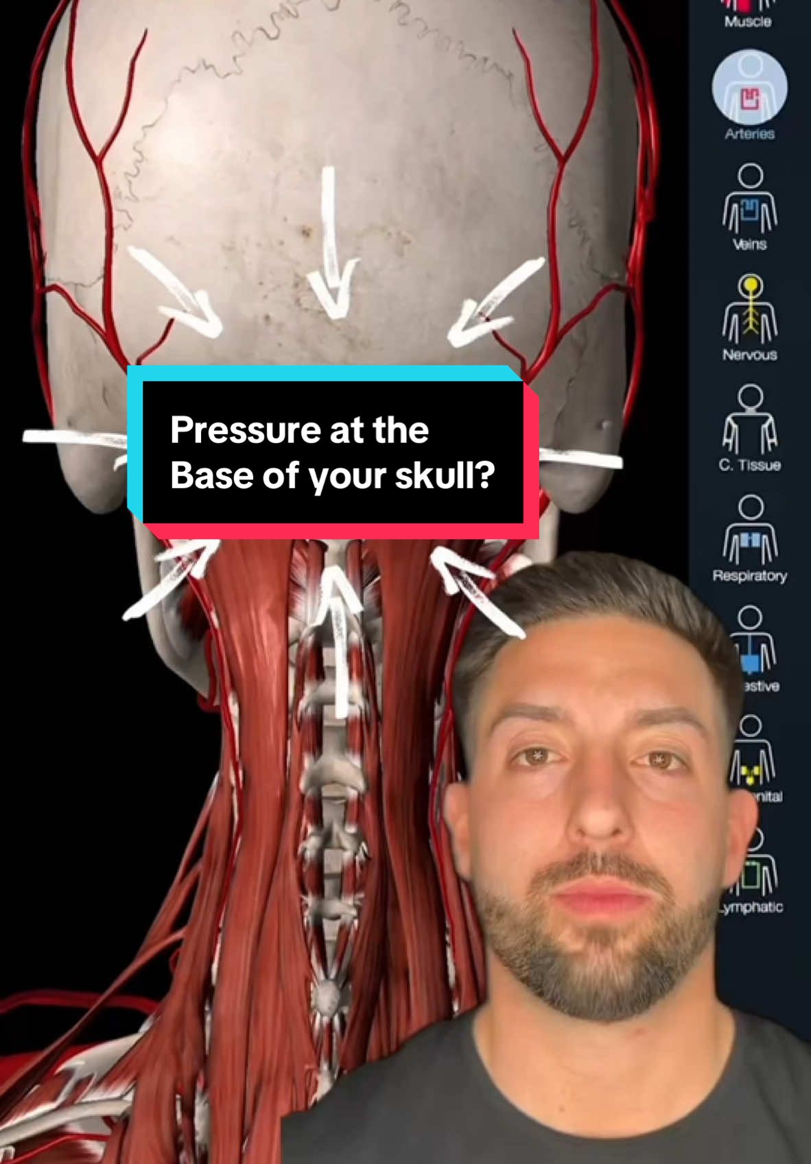 Do you have Pressure, Pain or Tightness in the base of your skull, plus a variety of unusual symptoms that no one has an answer for? Comment below if this describes you and we will explain how we can help!  #vertigo #dizziness #guthealth #uppercervical  #neckpain #seizures #anxiety #numbness #reels #foryou  #CapCut 