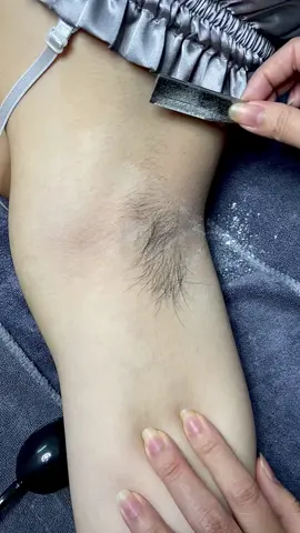 TẠI SAO NHẤT ĐỊNH PHẢI TRIỆT LÔNG NÁCH ✴️Tránh thâm đen vùng da nhạy cảm ✴️Tránh mùi hôi khó chịu ✴️Thoải mái mặc áo 2 dây ✴️Tự tin trong bộ đồ bikini nóng bỏng ✴️Liệu trình 10 buổi sẽ đánh bay mọi sợi lông cứng đầu nhất. Inbox để biết thêm chi tiết và đặt lịch #TriệtLôngLạnhĐàNẵng #camispadanang #triệtlongantoan #xuhuong 