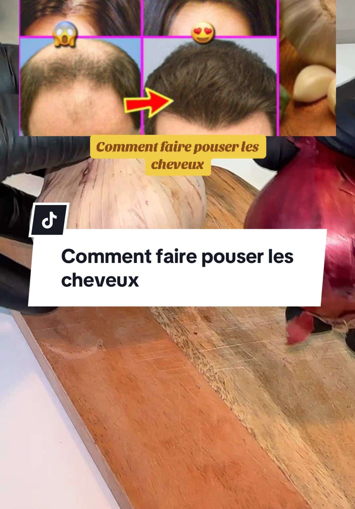 Comment faire pouser les cheveux#cheveuxlong #cheveuxnaturels #cheveuxlisses #astucecheveux #remedenaturel #chutedecheveux #remede #explore #france #ftpシ #remedenaturel #recettetiktok #cheveuxsains #conseilscapillaires  @وصفات  @وصفات  @وصفات 