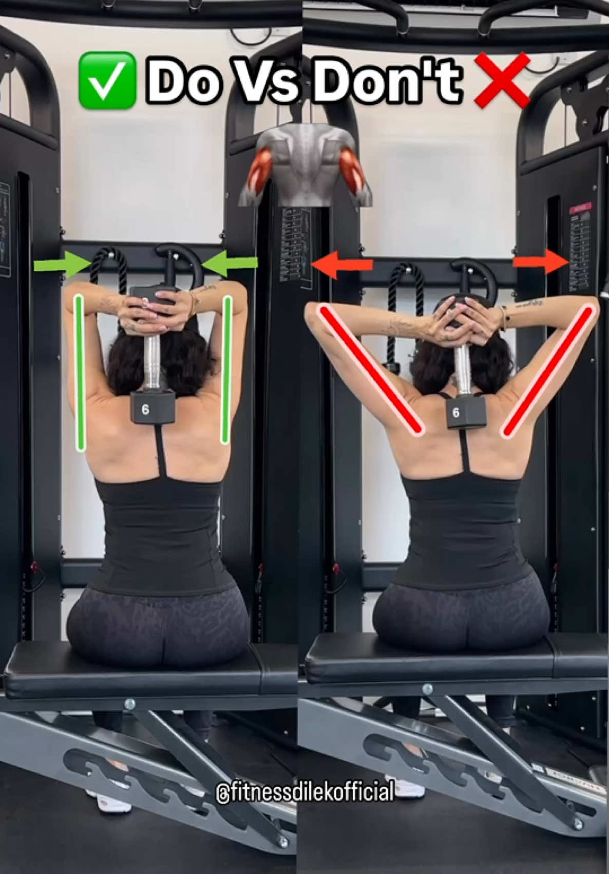 ✅ Do Vs Don't ❌  OVERHEAD TRICEPS EXTENSION: ❌ elbows drifting out, placing unwanted stress on the shoulders & removes tension from triceps ✅elbows tucked in, arms stay close to head ✅ower until elbows & forearms make 90-degrees keep upper arms still, just move at the forearm Hope this helps ❤️ Cc @fitnessdilekofficial #triceps #tricepsworkout #tricep #tricepsexercise #tricepsworkouts #fitnesstips #workouttips #gymtips