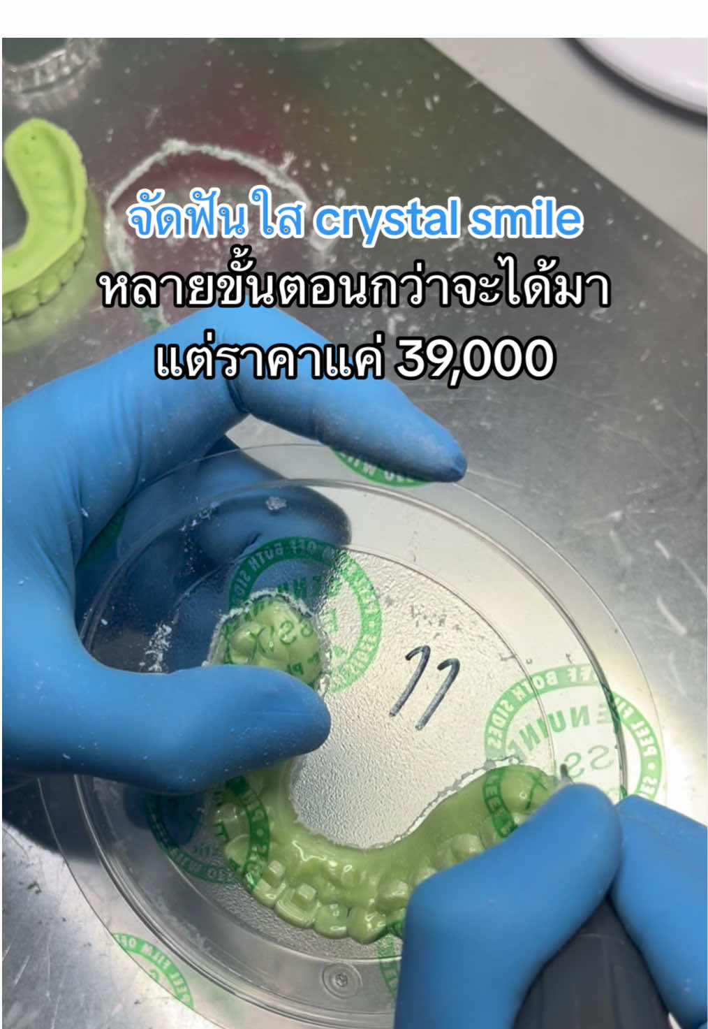 กว่าจะได้มาหลายขั้นตอนมาก แต่จบในราคาสุดคุ้ม ‼️💸 ##จัดฟันใสcrystalsmile#รีวิวจัดฟันใสcrystalsmile   ##crystalsmile   ##จัดฟันใสราคาไม่แพง   ##จัดฟันใส  ##จัดฟันใสแบรนด์ไทย  