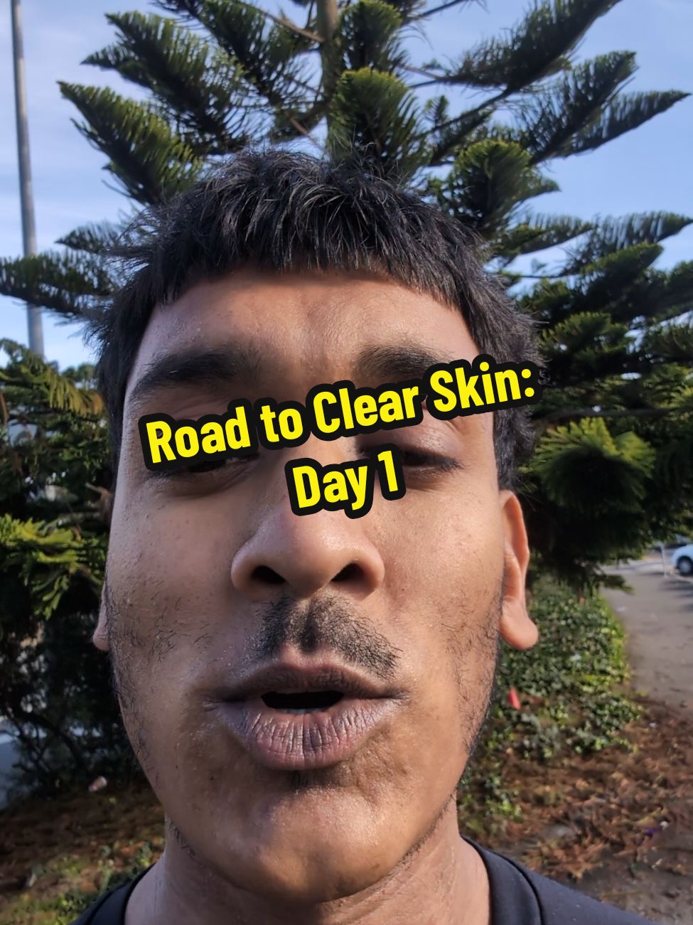 Road to Clear Skin: Day 1 #clearskin #clearskintips #skincare #skincareroutine #skincaretips #SkinCare101 #dryskin #psoriasis #perfectskin #roadtoclearskin #cerave #vaseline #kiehls 