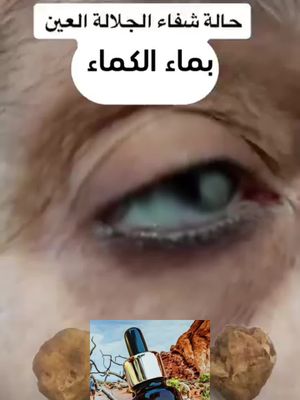 للطلب إضغط على الزر أسفله