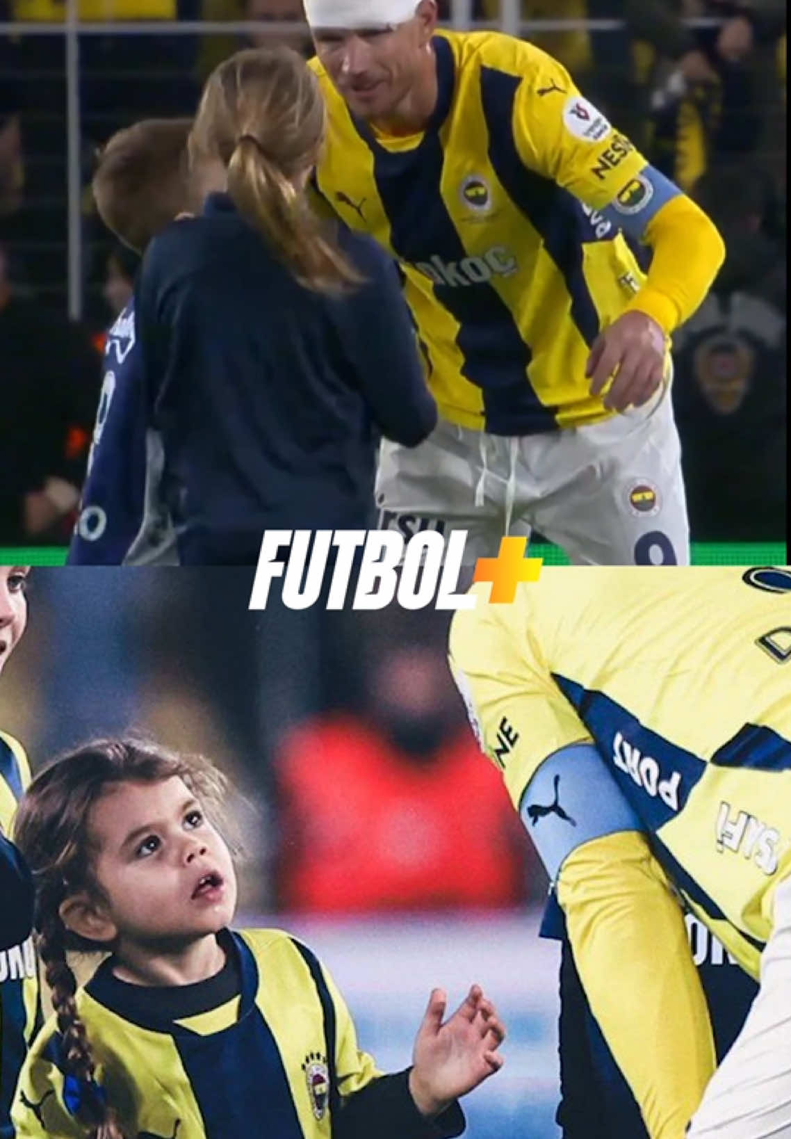 Edin Dzeko’nun kızının babasının yaralı yüzüne bakışı! 🥹 #Fenerbahçe #futbolunkalbi #sporhaberleri #sporgünlükleri 