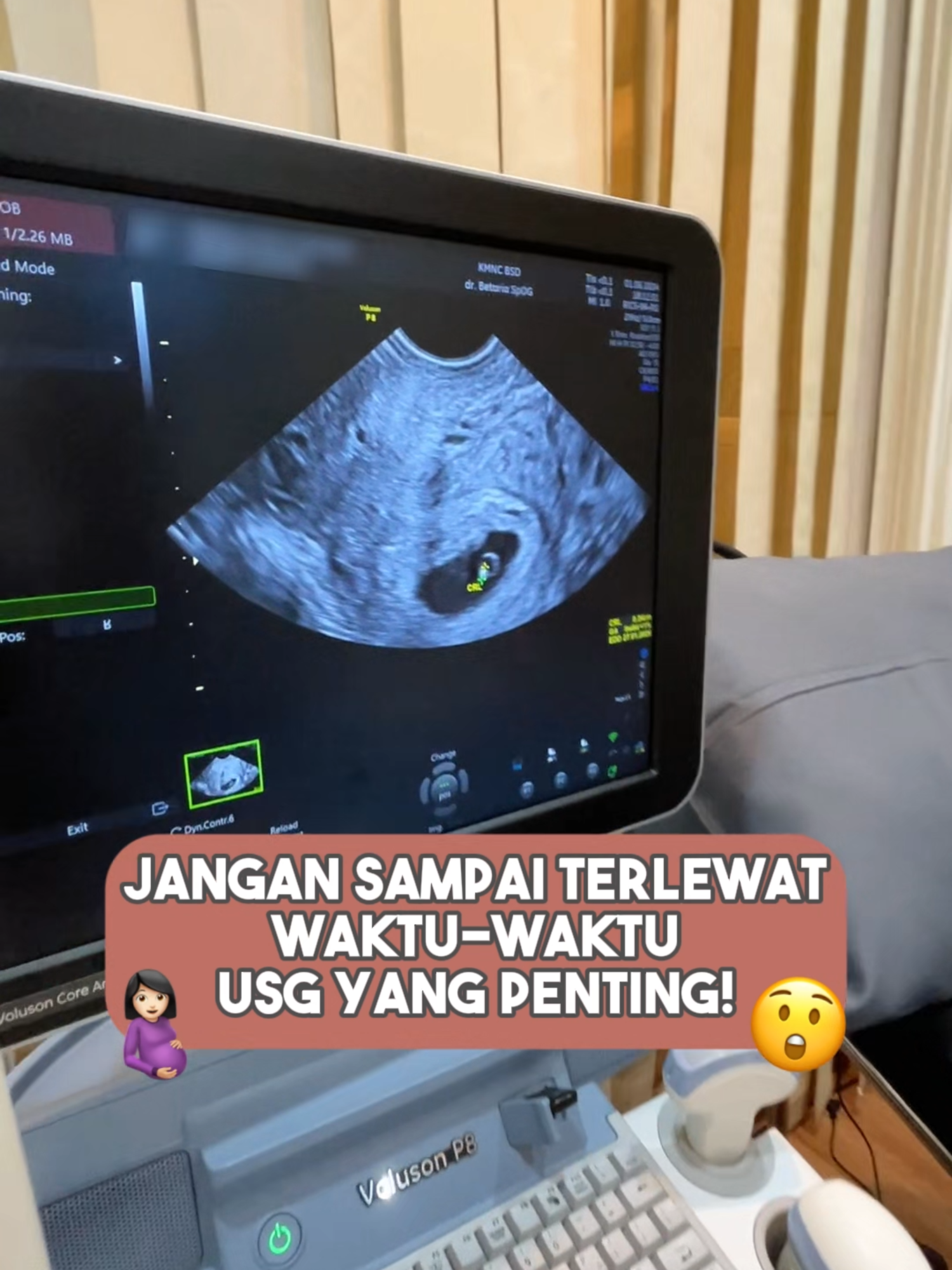 Hayo ibu-ibu udah pada USG belum nih? 🧐 #tipsbumil #tipsibuhamil #usg #usg4d