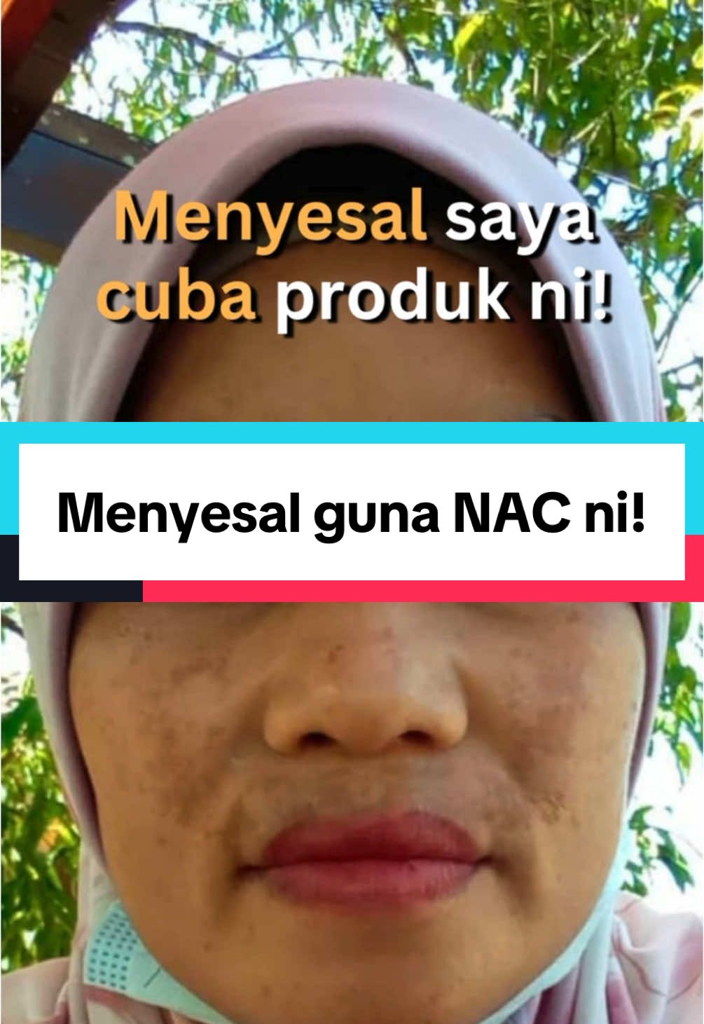 Rasa menyesal bila guna produk ni. Pudar habis jeragat saya, lepas tu kulit makin cerah dan glowing pulak. Pipi jangan cakap la kan, makin anjal! Siapa yang ada masalah macam saya, cepat-cepat grab NAC tau. Best giler! 😍 #nadeenagelesscream #nadeenbeauty #womendesiree #womendesireeagelesscream #skincare #antiaging #agelessfoamcleanser #ahopetoyouth #fyppppppppppppppppppppppp #wdac #nac #afc @NadNadeen 