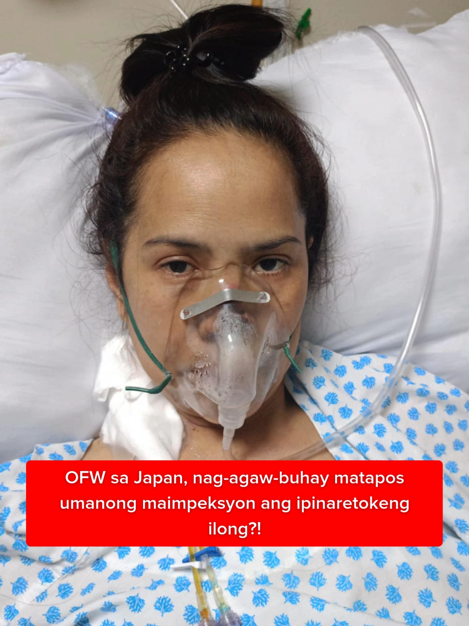 OFW sa Japan, nag-agaw-buhay matapos umanong maimpeksyon ang ipinaretokeng ilong?! #KMJS | Kapuso Mo, Jessica Soho