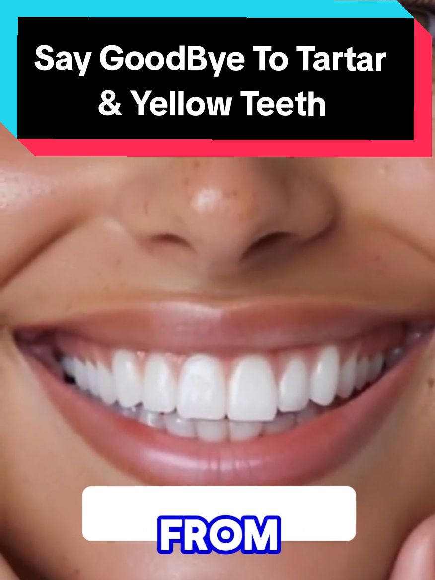 Whiten your teeth and remove tartar at home in just 2 minutes. Dentists will never reveal this secret to you. #teeth #whitening #Recipe #teethwhitening #teethwhiteninghack #whiteningteeth #teethcare #yellowteeth  You will get a beautiful and amazing smile from the first use. #naturalremedy #naturalrecipe #recipes #remedy 