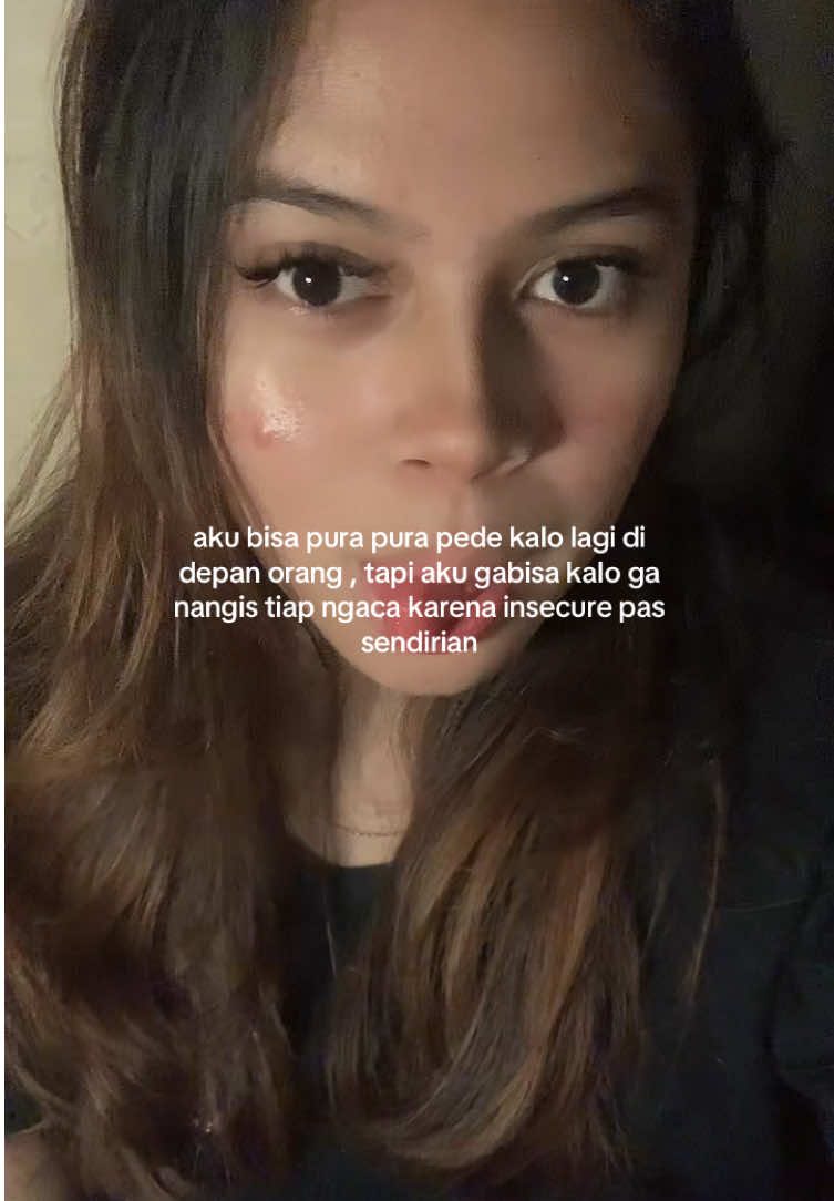 #acne #acneskin #acnefighter 
