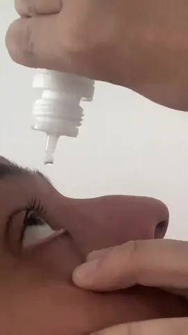 Ensinando a forma correta de pingar colírio nos olhos.