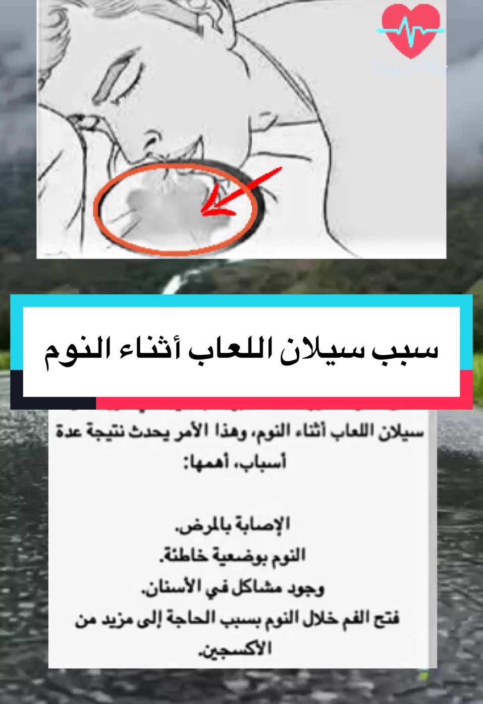 سيلان اللعاب أثناء النوم #معلومات_طبية #طبيب_تيك_توك #معلومات_مفيده #فوائد #علاج_طبيعي #infoburst #صحتك_في_بيتك #foruyou #fyp #اكسبلور #for #viralllllll #مملكة_الثقافة👑 #منارة_العلم🥀 #تيم #نصائح #طب_صيني 