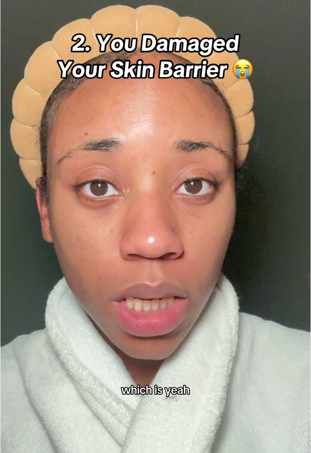 3 reasons why your stubborn dark spots arent fading 😅#darkspots #hyperpigmentation #acnejourney #skincaretips #acneskin #acnescars #acnejourney #blackgirlskincare #clearskin #SkinCare101 