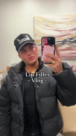 YEAH BUDDYYYY #lipfiller #Vlog #beauty 