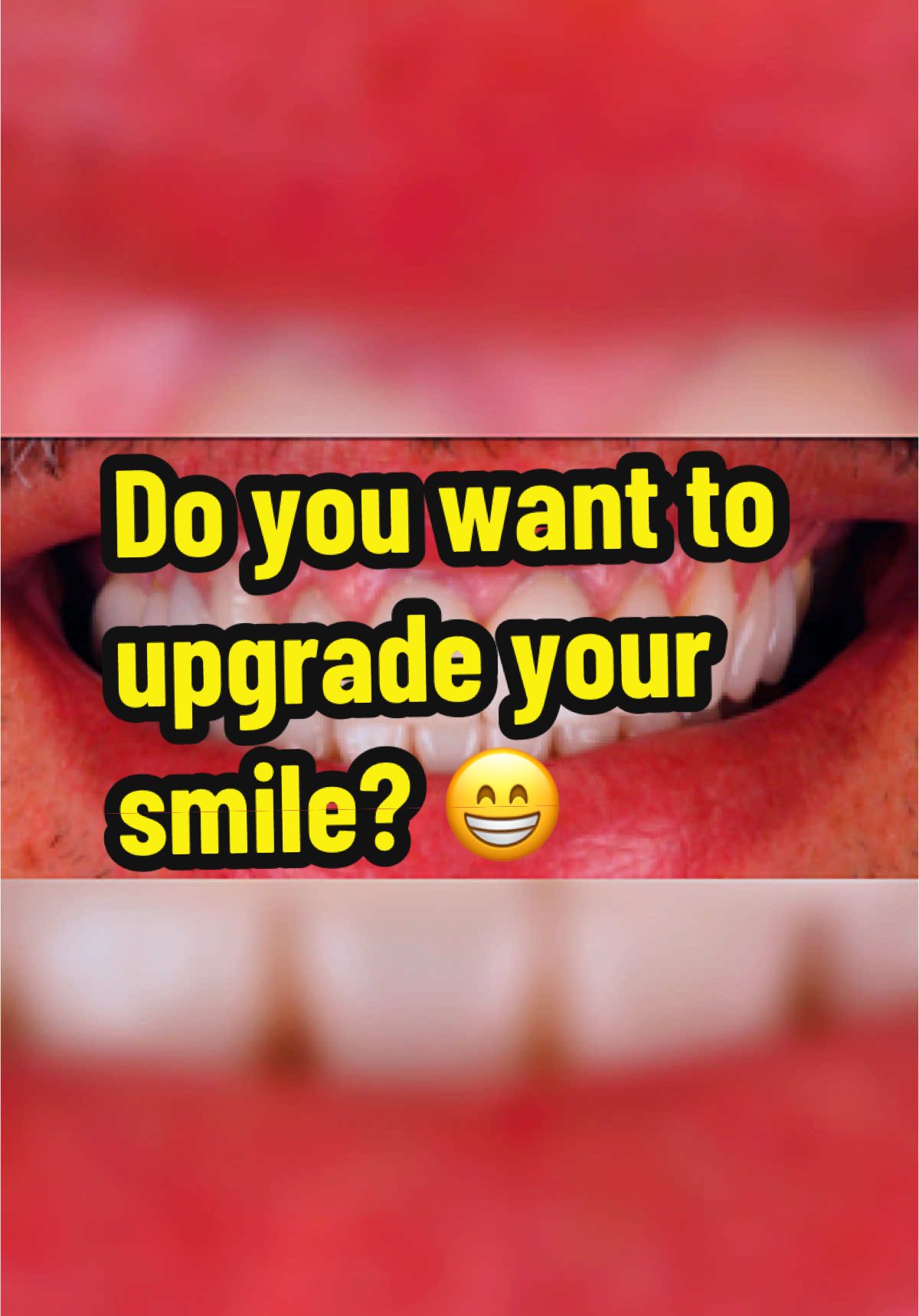 If you’re interested in finding out more about your smile the best way to move forward is click the link below. Submit a couple of selfies and tell me what you want to change.  I’ll then send you back a personalized video explaining you all your options. https://austinartisticdental.com/virtual-consult/ 512-550-3338 #cosmeticdentist #porcelainveneers #veneers #compositeveneers #austindentist #dentaltips #austincosmeticdentistry #dentaladvice #bioclear #bioclearmethod #dentist #cosmeticdentistry #dentistry #smile #veneers #smilemakeover #dental #teethwhitening #invisalign #teeth #dentalimplants #smiledesign #porcelainveneers #oralhealth #compositebonding #orthodontics #dentista #dentalcare #familydentist #restorativedentistry #dentalphotography #dentistryworld #dentistrylife #dentalveneers #dentistlife #aestheticdentistry #braces #smiletransformation