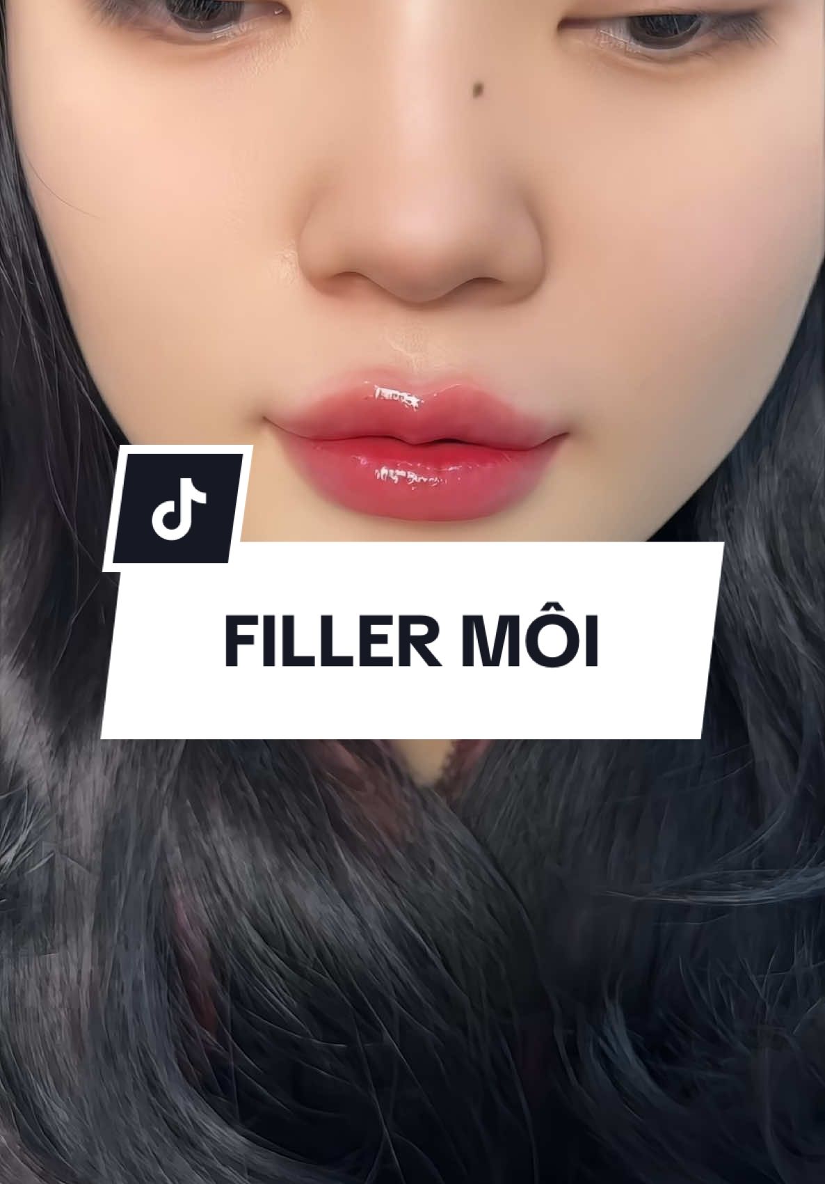 Up thêm quả clip nữa cho mấy bà ngắm đã cái nư 😘 #tiêmmôi #fillermoi 