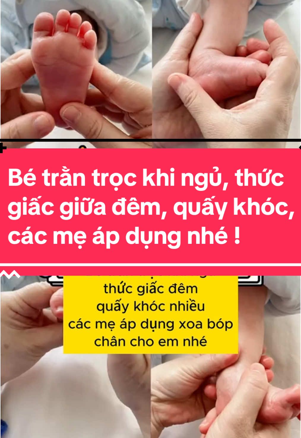 Bé trằn trọc khi ngủ, thức giấc giữa đêm quấy khóc nhiều, các mẹ áp dụng nhé ! 💯✅#xoabopbamhuyet #yhoccotruyen #yhcttrunghoa #khocdem #trequaykhoc