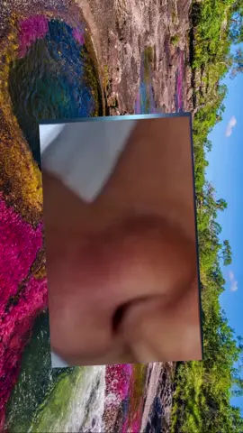 #squeezie #squeezeyuk #acne #pimple #pimplepop #blackhead #satisfyingvideos #fyp