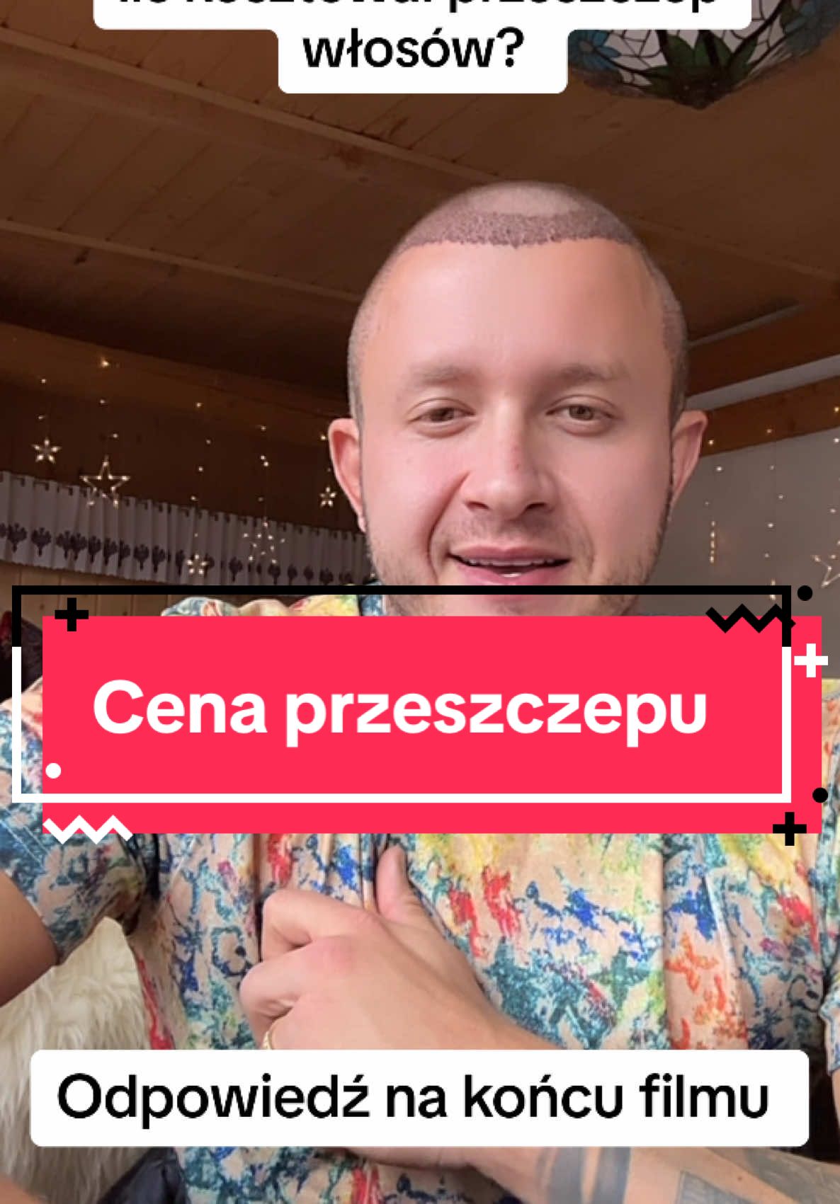 Wszystkie wątpliwości rozwiane rozwiane?🙈❤️#piekniimlodzi #przeszczepwlosow @Flymedica @joanna_narozna 
