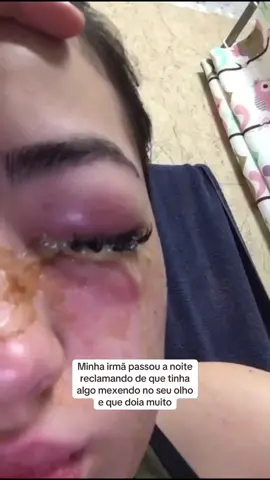 Pior dia da minha vida💔💔💔💔💔💔😭😭😭😭😭🥹🥹🥹🥹🥹🥹🥹🥹🥹 #hospital #medicos #desesperada #olho #salaodebeleza #cilios
