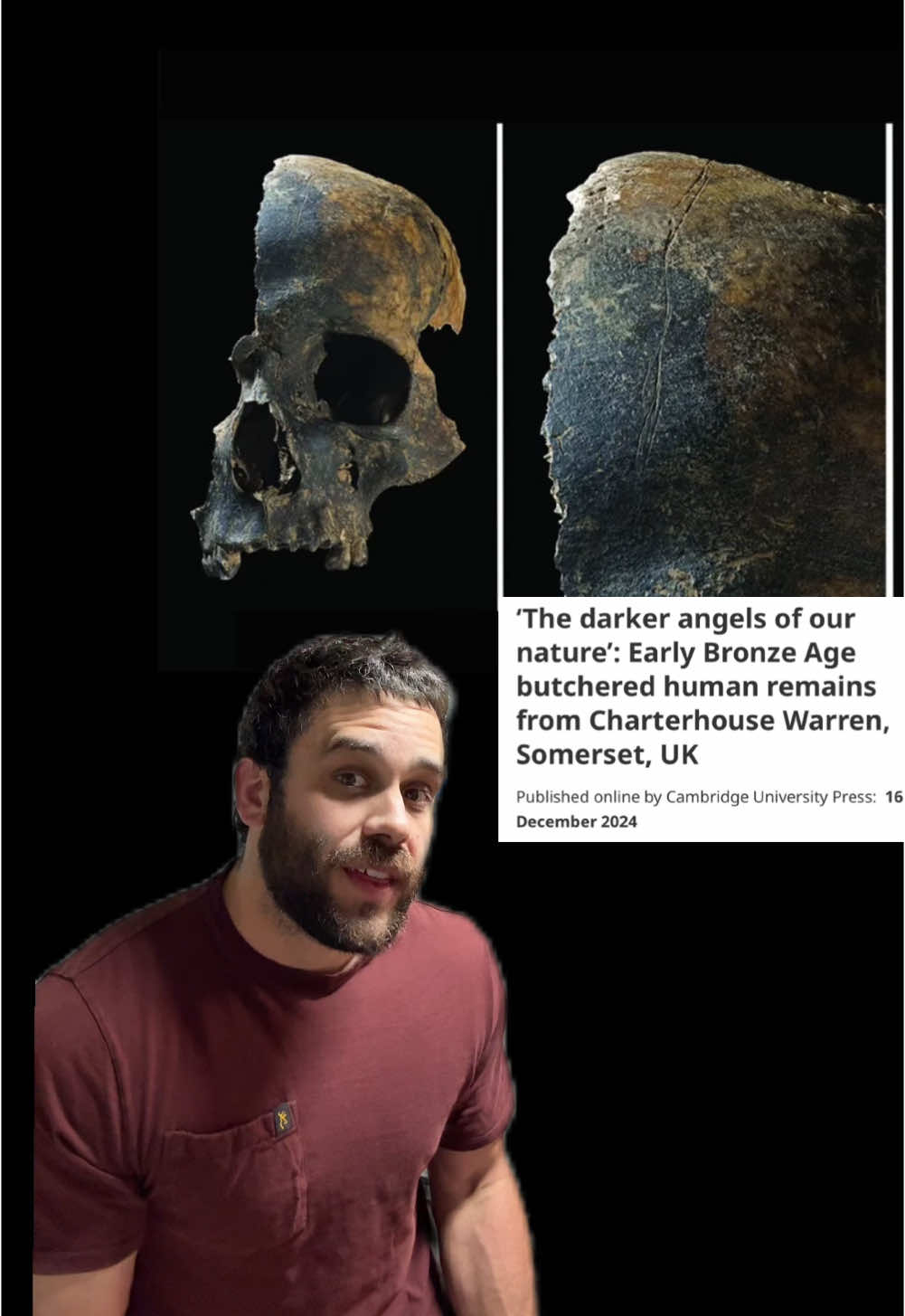 Is this the most horrific archaeology site? #sciencetok #archaeology #anthropology #LearnOnTikTok #edutok #stem #brutal #war #horror #mystery #somerset #unitedkingdom #evolution #scienceteacher  