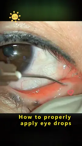 #eyes 