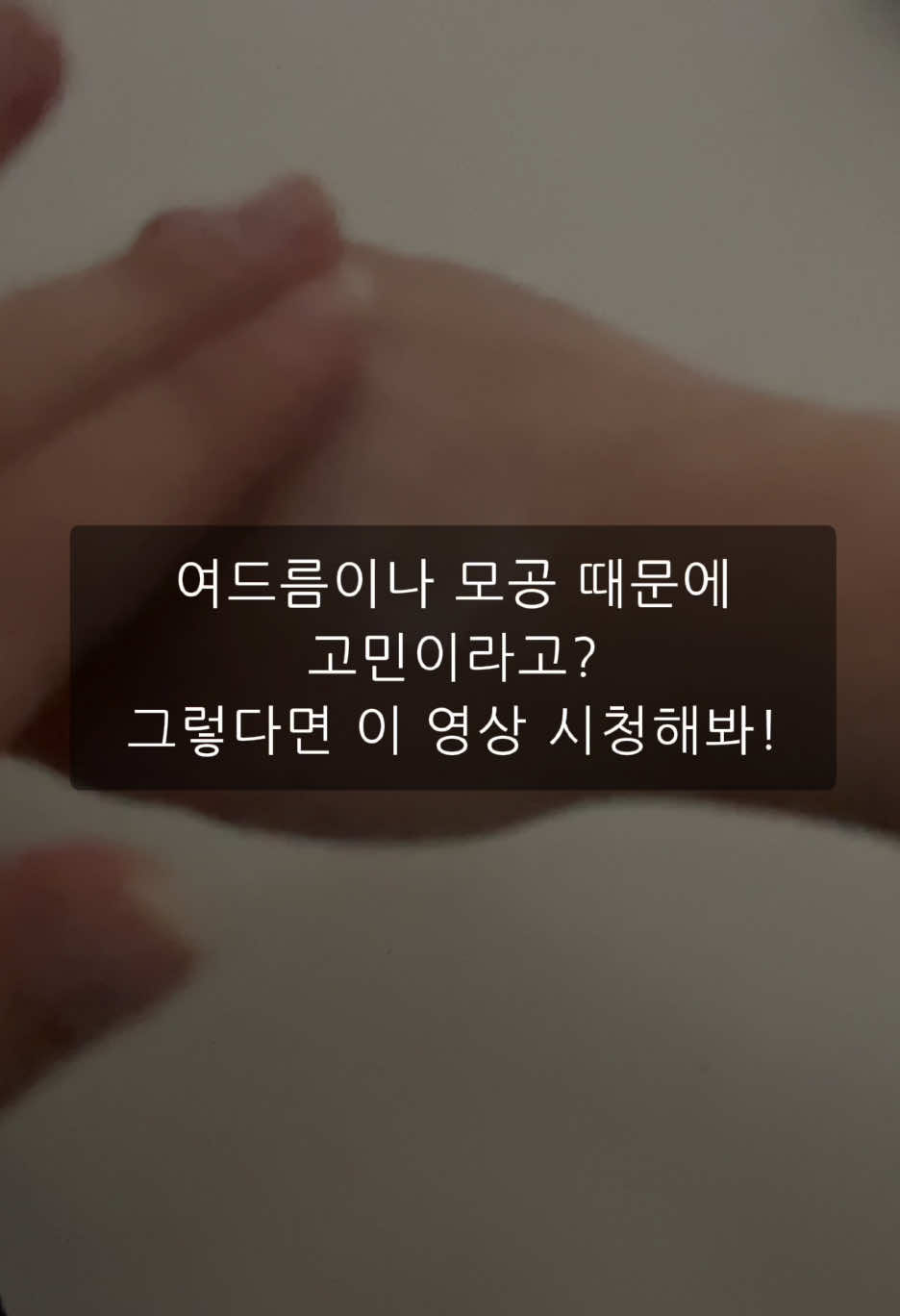 여드름 성 피부 때문에 고민이라고? 당장 여기로 달려가.  10년동안 사랑 받은 화해 1위 좁쌀여드름 크림! 10년동안 1위한 이유가 있더라? 이 제품 내가 평소에도 사용하던 제품이라 협찬 왔을 때 기쁘기도 했고 이 크림을 사용하고 나서부터 내 피부가 진짜 좋아져서 너네한테 소개하기에 딱 좋을 것 같아 들고왔어!  이건 저자극 테스트도 완료한 크림이라 믿을 수 있는 좁쌀여드름 크림이야 씻고 토너, 세럼을 바르고 이 크림 발라주면 되는데 난 겨울이라 수분 크림도 발라줬어! (이 크림만 발라도 충분해)  카메라에 내 얼굴 나왔을 때도 피부가 깨끗하니깐 보기에도 좋더라 지성피부는 바데카실P를 사용하면 되고, 민감성 피부는 바데카실D를 사용하면 돼! 한 번 믿고 사봐. 그럼 계속 주문하게 될 걸?  #23yearsold #바데카실 #좁쌀여드름 #여드름피부 #좁쌀여드름크림 #해시태그하나만했는데설마추천이겠어 #협찬 