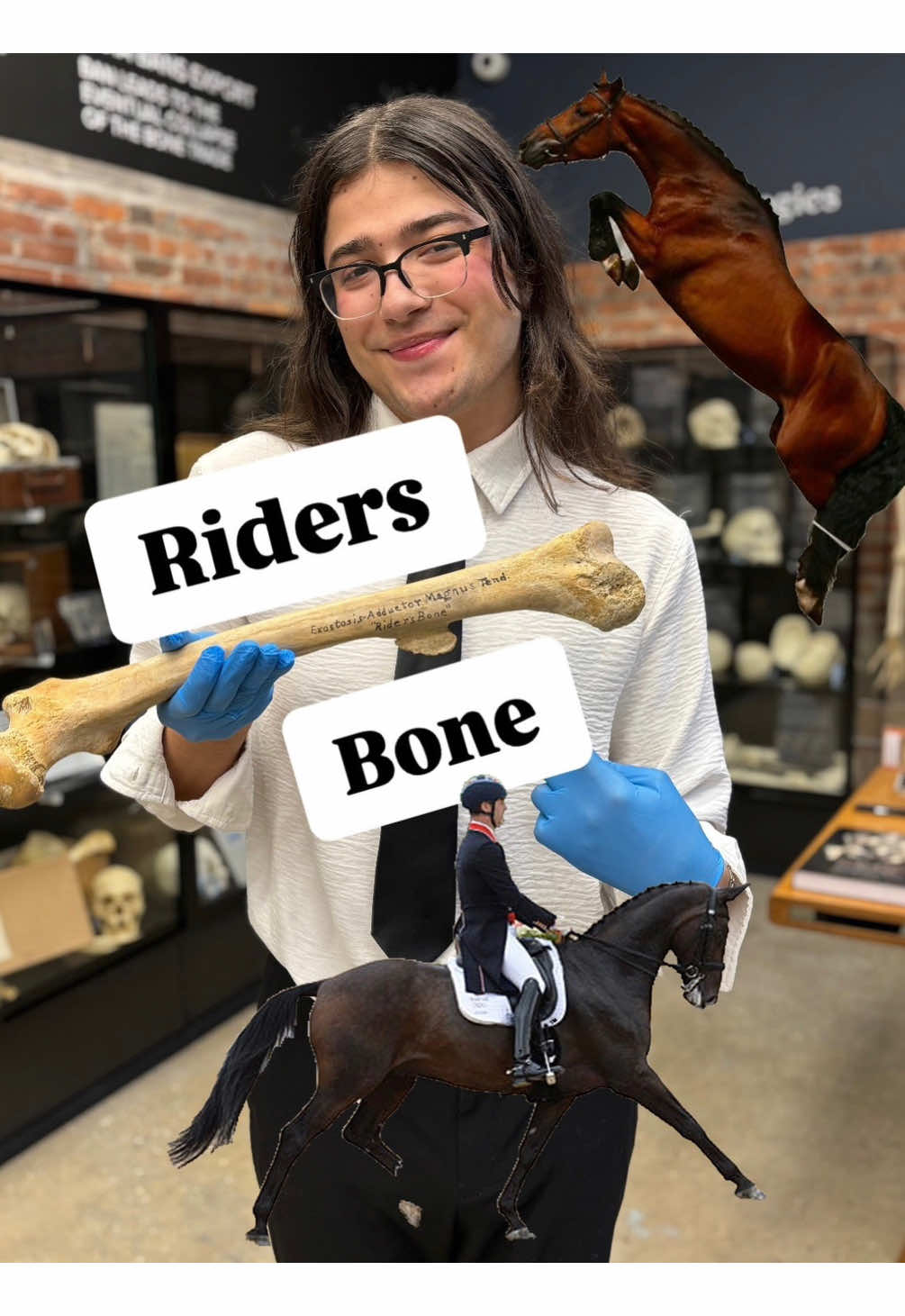 Rider bones are fascinating examples of how the body adapts to repeated stress! These extra bone growths, also known as exostoses, form where the muscles and ligaments repeatedly pull on the bone, like on the inner thighs or pelvis in horseback riders. In the past, long hours on horseback made these growths more common, today, they’re far less common thanks to advancements in riding gear, better saddles, and fewer people relying on horses for daily transportation. Modern riders, with improved techniques and shorter riding durations, are less likely to develop these bone changes, but they still serve as a fascinating reminder of how the body adapts to its environment!