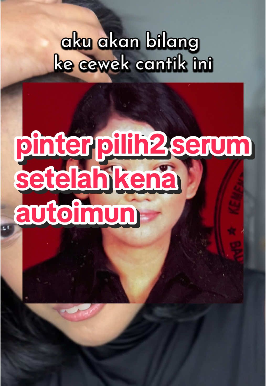 skincare-an itu salah satu cara aku semangat hidup berdamai setelah kena autoimun, malah jadi paham caranya pilih2 skincare dgn kandungan yg aman non overclaimed #autoimmunedisease #foryoupage 