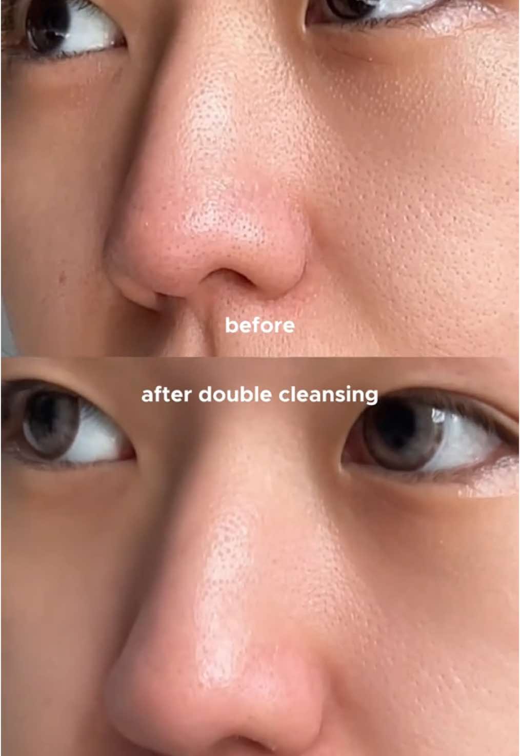 CLOGGED PORES LANGSUNG BERSIH 🥹😭 @ANUA Indonesia #ANUA #ANUAIndonesia #cleansingoil #cleansingfoam #micellarwater #doublecleansing #skincareroutine #kbeauty 