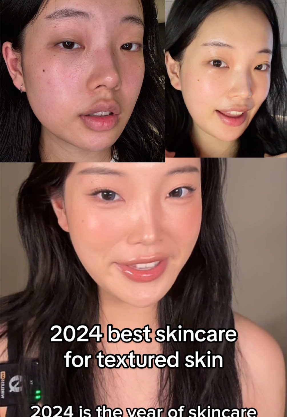 How I got rid of my texture skin in a year!!!! Best products of 2024! #koreanskincare #kbeauty #skincare #texturedskin #enlargedpores #ipldevice #2024skincare #skincarefavourites 