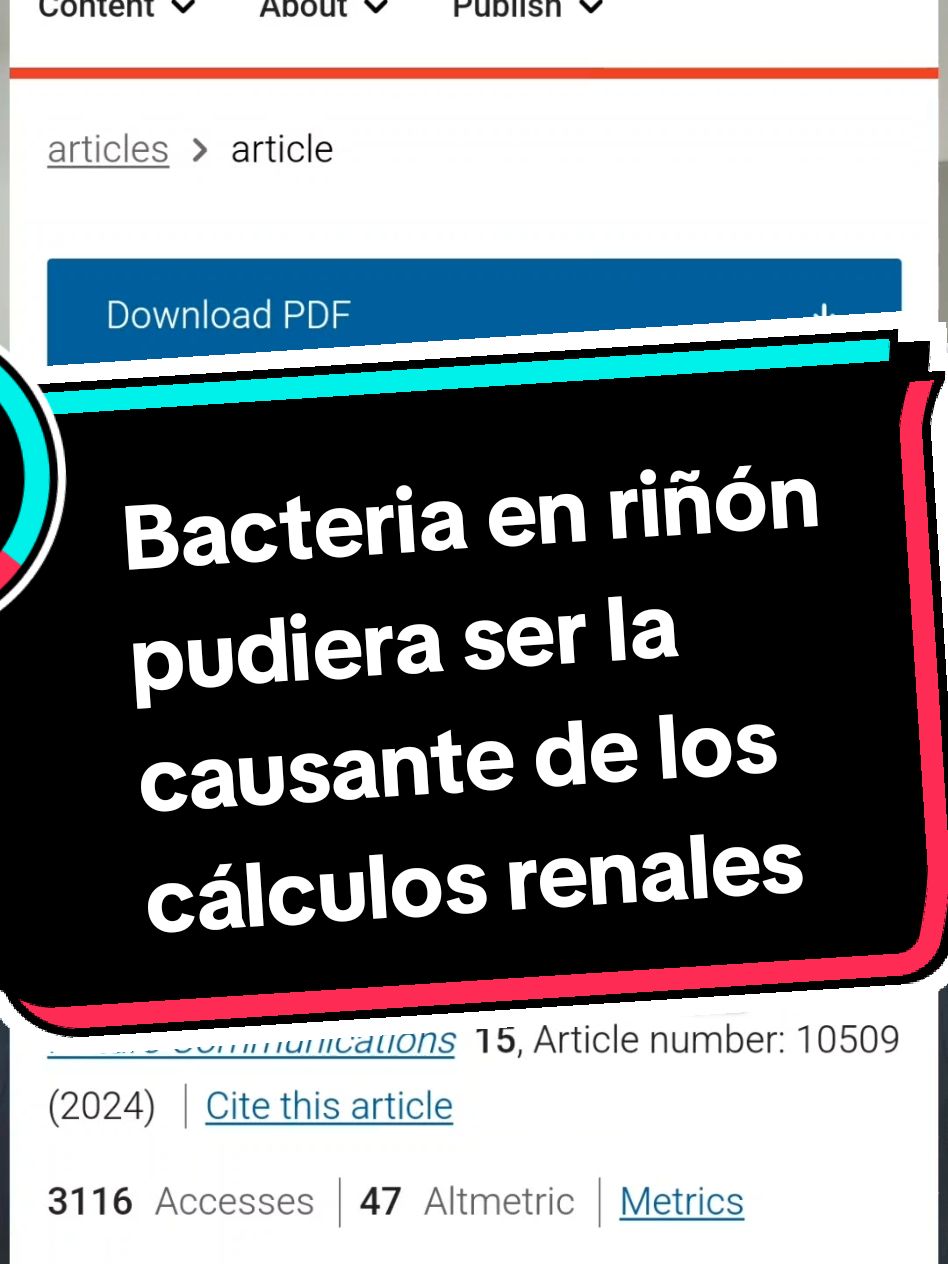 Superar la suposición de que el tracto urinario es estéril es vital para proponer tratamientos y opciones preventivas para enfermedades renales.  Investigadores observaron que la bacteria e. coli en el riñón pudiera causar cálculos renales mientras que lactobacillus crispatus pareciera bloquear la capacidad de la e. coli para formar los cálculos.  Un artículo muy interesante.  #ciencia #medicina #cienciaentiktok #science #calculosrenales #microbioma #articuloscientificos #revistascientificas #avancescientificos #cienciadevanguardia #riñon #urologia 