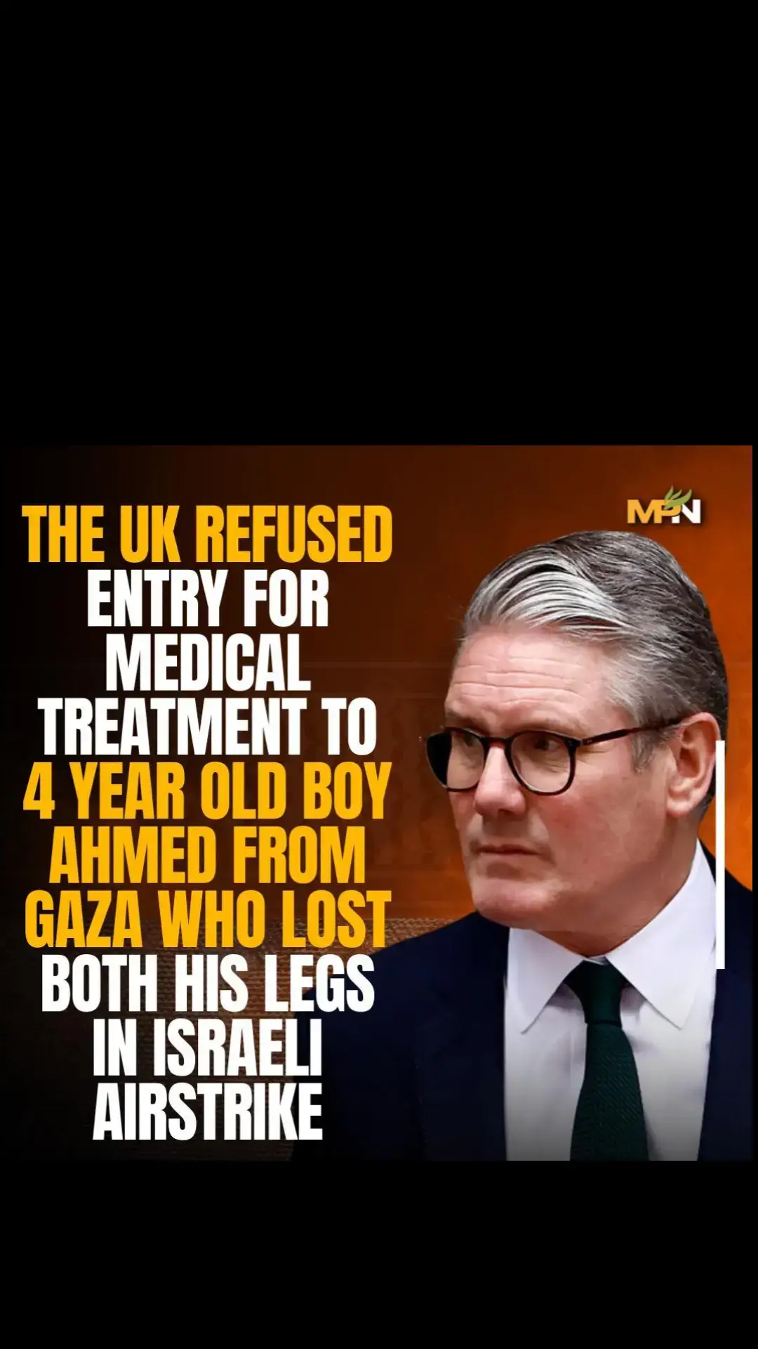 The 4-year-old Ahmed is now receiving medical treatment in Italy, after being denied entry into the UK. The child from Gaza lost both his legs and the majority of his family members in an Israeli airstrike. Over 50 British MP’s wrote to the Prime Minister Keir Starmer urging him to allow the Palestinian child to enter the UK for treatment but are yet to receive a reply.