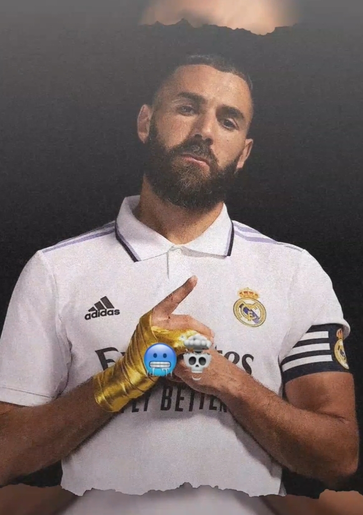 cedera yang mengawali prime Karim Benzema 👽👽. #fyp #lewatberanda #sb #realmadrid #fypシ #karimbenzema #ligachmapionsligue #ucl #semogafyp #fypシ゚viral #viraltiktok #football #jj #xyzbca #yxzcba #benzema #elxiann 