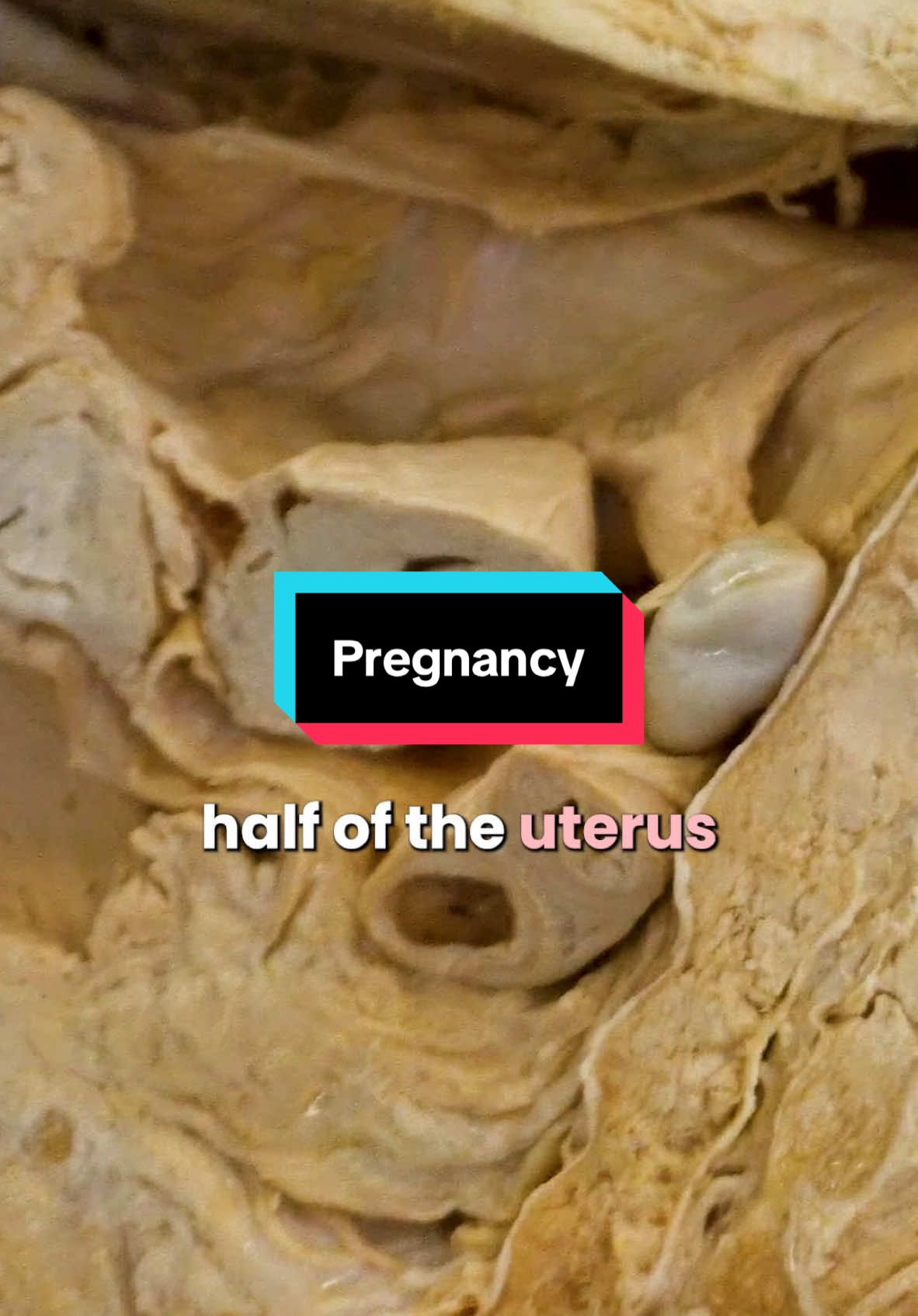Body Shifts During Pregnancy #pregnant #baby #amazing #fyp 