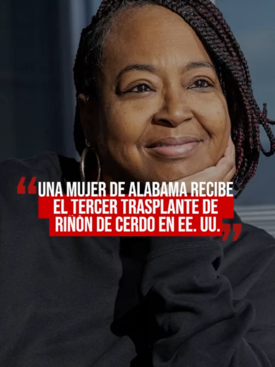 📌UNA MUJER DE ALABAMA RECIBE EL TERCER TRASPLANTE DE RIÑÓN DE CERDO EN EE. UU Aquí te contamos a detalle porque somos Las Noticias en su justa dimensión.😎👊 #fyt #noti #noticias #medicina