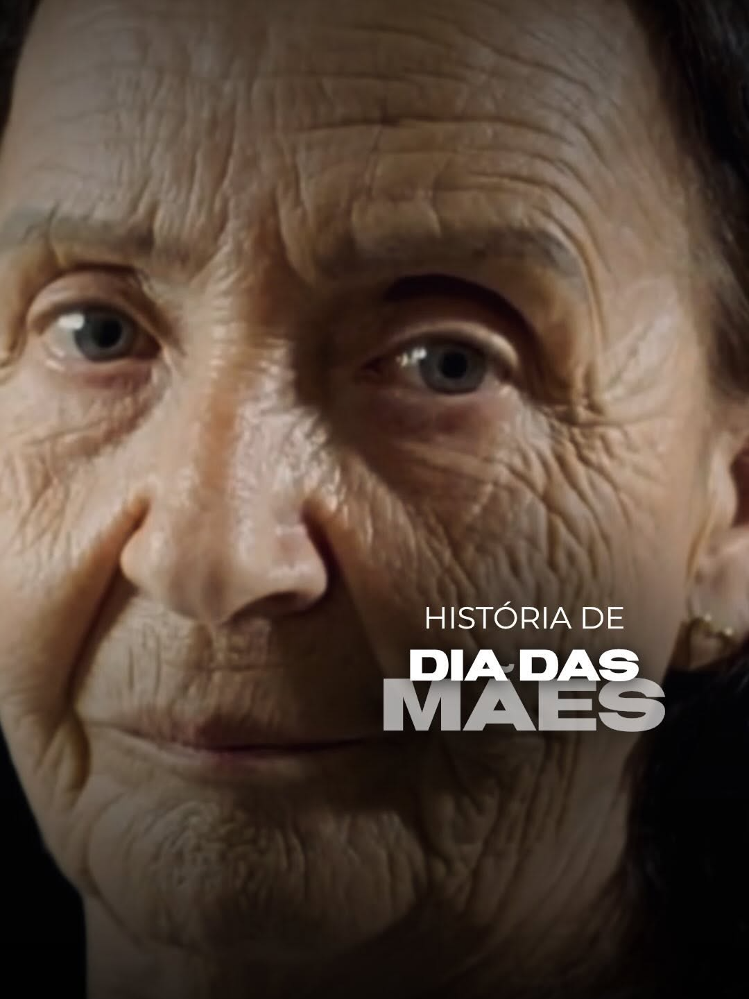 ✨ Conheça a história de Dia das Mães da Dirce 👉🏻 Procedimentos realizados: - Peeling  - Lifting facial - Blefaroplastia superior e inferior  - Botox  - Implantes dentários @ruzzarinodontologia  🗓️ Agende sua avaliação. Clinica Harmonia CRM/RS 11664 RT Dra Mariana Losso CRM/RS 35458 RQE 33622 CRM/RS 11664 RT: Dra Mariana Losso - CRM/RS 35448 Dermatologista - RQE33622 #dermatologia #rejuvenescimento #rejuvenescimentofacial #peeling #lifting #liftingfacial #preenchimentofacial #preenchimento #acidohialuronico #harmonizacaofacial #liftingfacial #deepplanefacelift #autoestima  ✅Publicação de caráter acadêmico em conformidade com o despacho 143/2019 Conselho Federal de Medicina, art. 75, e autorizado via Termo de Consentimento Informado. ✅O resultado imediato pode sofrer alterações da cicatrização, inchaço, reabsorção das estruturas e pode não ser o mesmo após vários meses ou anos. Pode ter melhor definição ou perdê-la com o tempo dependendo das características de cada paciente. ✅Além disso, esse video NÃO serve como um modelo a ser escolhido para a sua cirurgia, pois o resultado sempre será de caráter individual e pessoal. Não garantimos resultados.