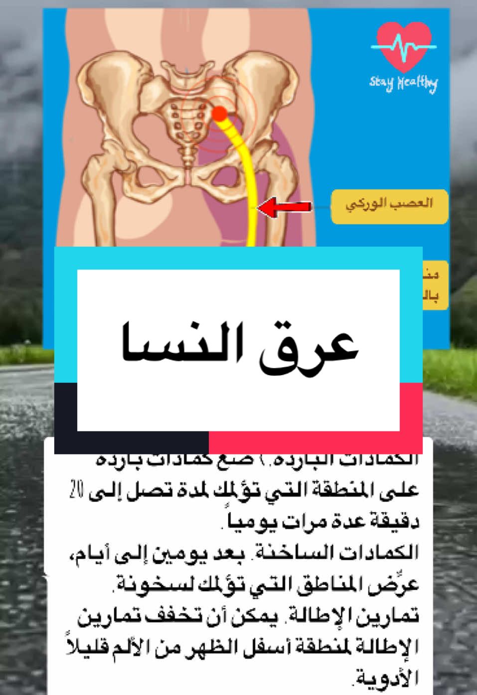 علاج عرق النسا في المنزل#طبيب_تيك_توك #معلومات_مفيده #معلومات_طبية #علاج_عرق_النسا #منارة_العلم🥀 #علاج_طبيعي #طب_صيني #نصائح #فوائد #تيم #viralllllll #for #fyp #foruyou #اكسبلور #صحتك_في_بيتك 