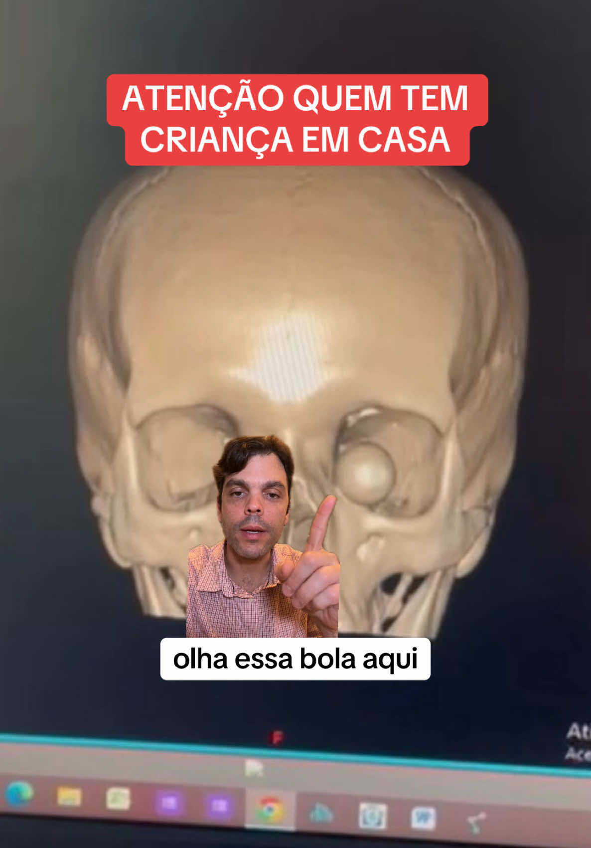 ALERTA ‼️ 🚨 🔔 REPASSE! #oftalmologia #drjoaopaulolomelino #alerta 