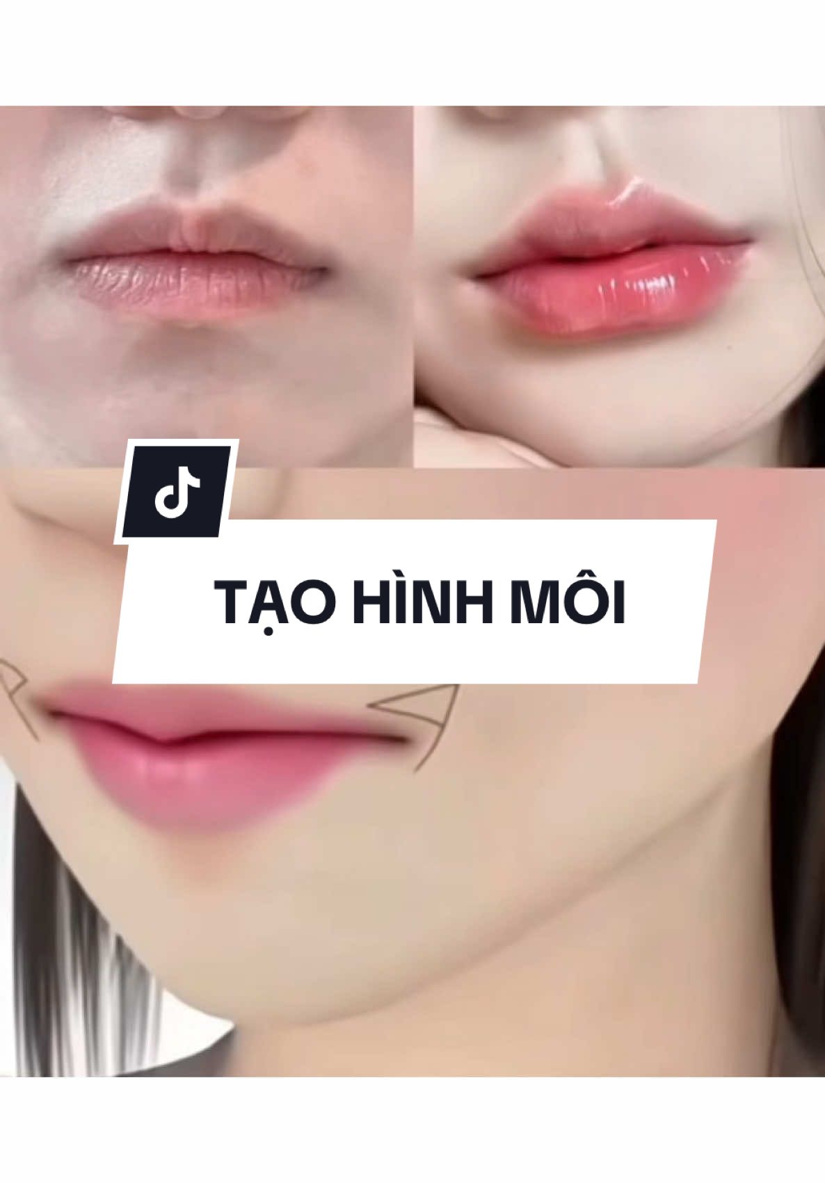 #catmoi #taohinhkhoecuoi #surgery #xhtiktok #beauty #taohinhmoi