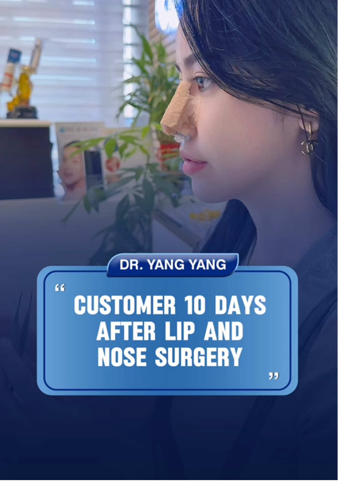 Nose and Lip Surgery Recovery in 10 Days #goretex #rhinoplasty #fyp #barbie #barbienose #views #quezoncity #manila #philippines #dryang 