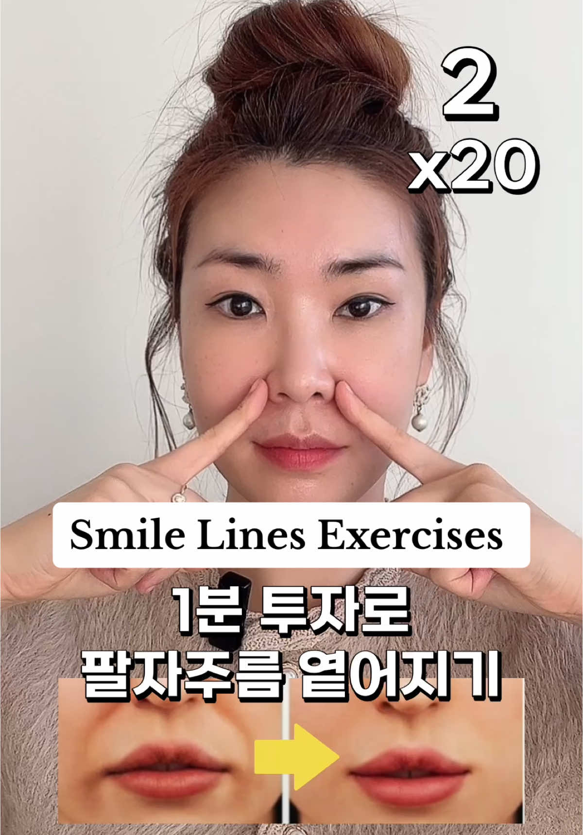 ✅하루 1분 투자로 팔자주름 옅어지는 꿀팁!☝🏻 ⠀ 소리켜고 설명 끝까지 한 번 듣고 하시면 따라하기 더 쉬우실 거예요😊 ⠀ 팔자주름이 시작되는 위입술 올림근만 잘 풀어줘도 팔자주름 개선에 도움되어요❤️ ⠀ 1️⃣손가락을 반회전하면서 20번 튕겨주세요 2️⃣손가락을 반회전하듯 들어올리면서 3초간 머물러주세요 (총 20회) ⠀ ⠀ ⠀ ✅1-Minute Daily Tip to Soften Nasolabial Folds! ⠀ By simply relaxing the levator labii superioris (the muscle above your upper lip where nasolabial folds begin), you can help soften smile lines. ⠀ Here’s how: 1️⃣Flick your fingers in a half-rotating motion 20 times. 2️⃣Lift your fingers in a half-rotating motion and hold for 3 seconds. (Repeat a total of 20 times.) ⠀ Try it out and enjoy the results! 💕 ⠀ ⠀ ⠀ #페이스요가 #팔자주름 #faceyoga #nasolabilfolds #smilelines ⠀