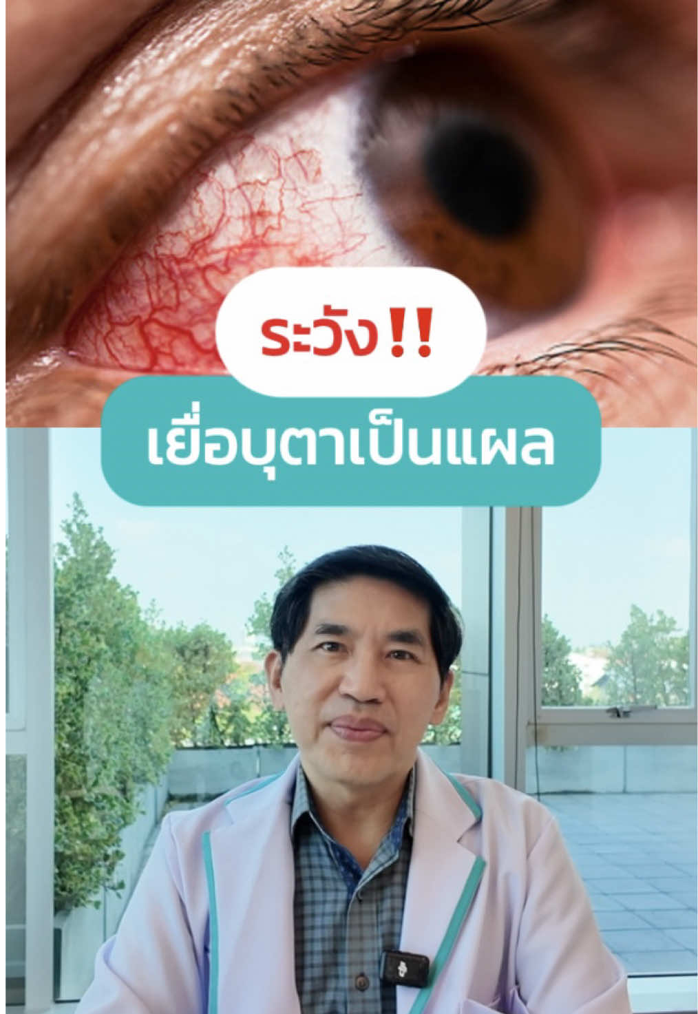 เจ็บตา เคืองตา ระวังเยื่อบุตาเป็นแผล!!! #โรงพยาบาลจักษุกรุงเทพ #bangkokeyehospital #โรงพยาบาลตา #eyehospital #จักษุแพทย์ #โรคตา #หมอตา  #ความรู้ #hospital #TikTokUni #เยื่อบุตา