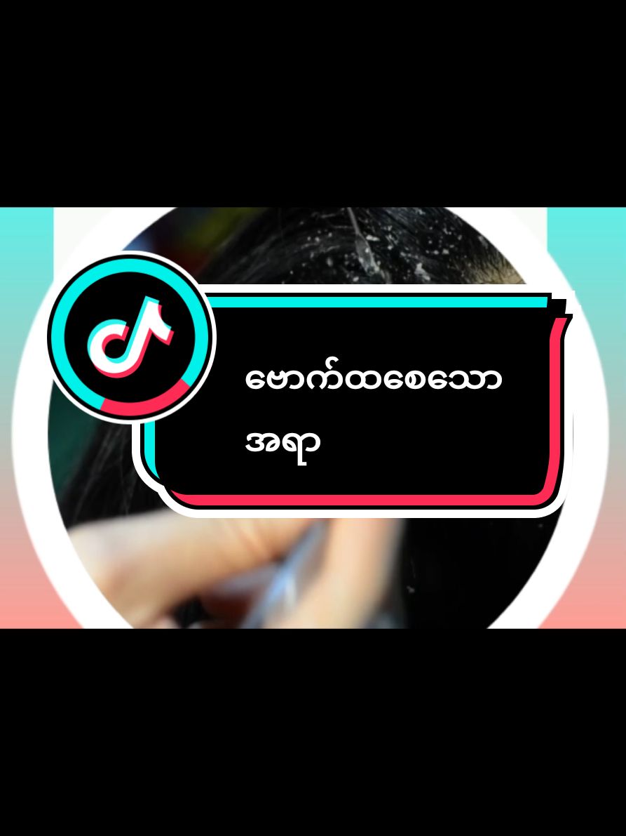 #ဗောက်ထသူများ #ဗောက်ပျောက်ချင်သူများ #ဗောက်ပျောက်ခေါင်းလျှော်ရည် #ခေါင်းလျော်ရည် #tiktokmarket #tiktok #shampoo #hairproduct #nweniooshampoo #foryou @Nwe Ni Oo @Nwe Ni Oo @Nwe Ni Oo 