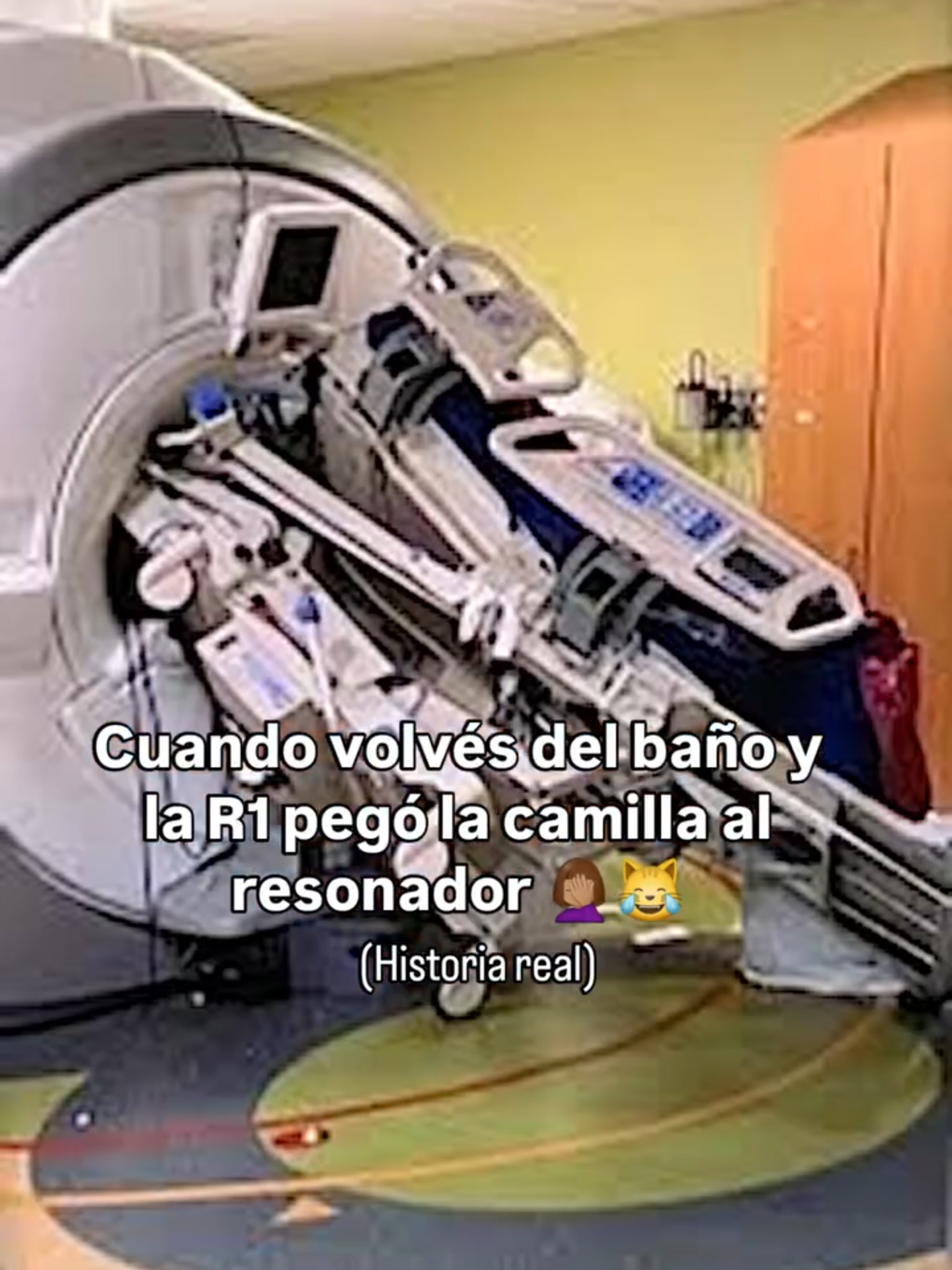 La dejé sola un minuto y cuando volví estaba llorando y la camilla pegada al resonador con el paciente encima de la camilla 🤦🏽‍♀️ Mientras ella charlaba con el residente de neuro que vino con el paciente, el camillero, que era nuevo, simplemente hizo su trabajo (pasar al paciente), pero nadie le dijo que esa camilla NO podía ingresar al reso por ser ferromagnética y pasó lo que ya sabemos...el resonador atrajo a la camilla. Por suerte no la volteó y el paciente no sufrió ningún daño....después de sacar al paciente del resonador, entre muchos tiraron de la camilla y por acción divina lograron despegarla. Fue una situación estresante...No podes descuidarte ni un segundo en un resonador. ¿Por qué el resonador no volteó la camilla? Porque si bien tenía partes ferromagnéticas, muchas otras eran plásticas...pero si hubiera sido toda de metal, la historia sería otra. Uds vivieron una situación así? #radiologia☢️ #radiología #radiologo #tecnicoradiologo #tecnologomedico #rmi #medicina #tomografia #rayosx #tecnologo #radiologia☢️ #radiologia #trabajo #viral #meme #diagnostico #diagnosticoporimagem #diagnosticoporimagenes #resonanciamagnetica #medicoradiologista #medicoradiologo #radiologia #humor #humor