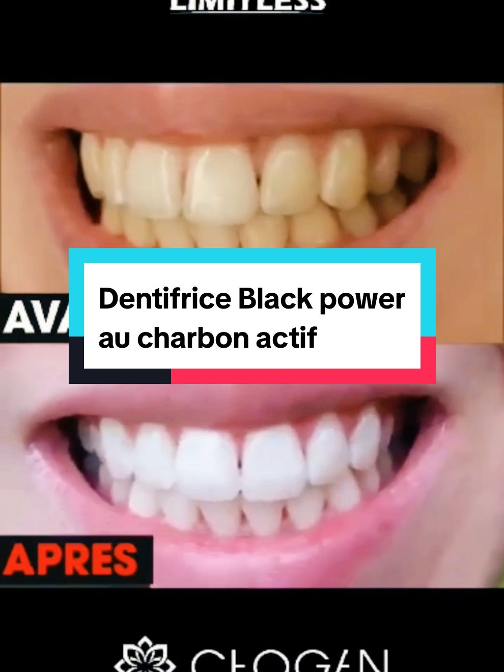 Black power dentifrice au charbon actif élimine des bactéries, éclaircit les tâches dentaires et exerce une action blanchissante grâce à sa formule au charbon actif.  #charbonactif #chogan #dentifrice #blanchissant #christlesenteurs 