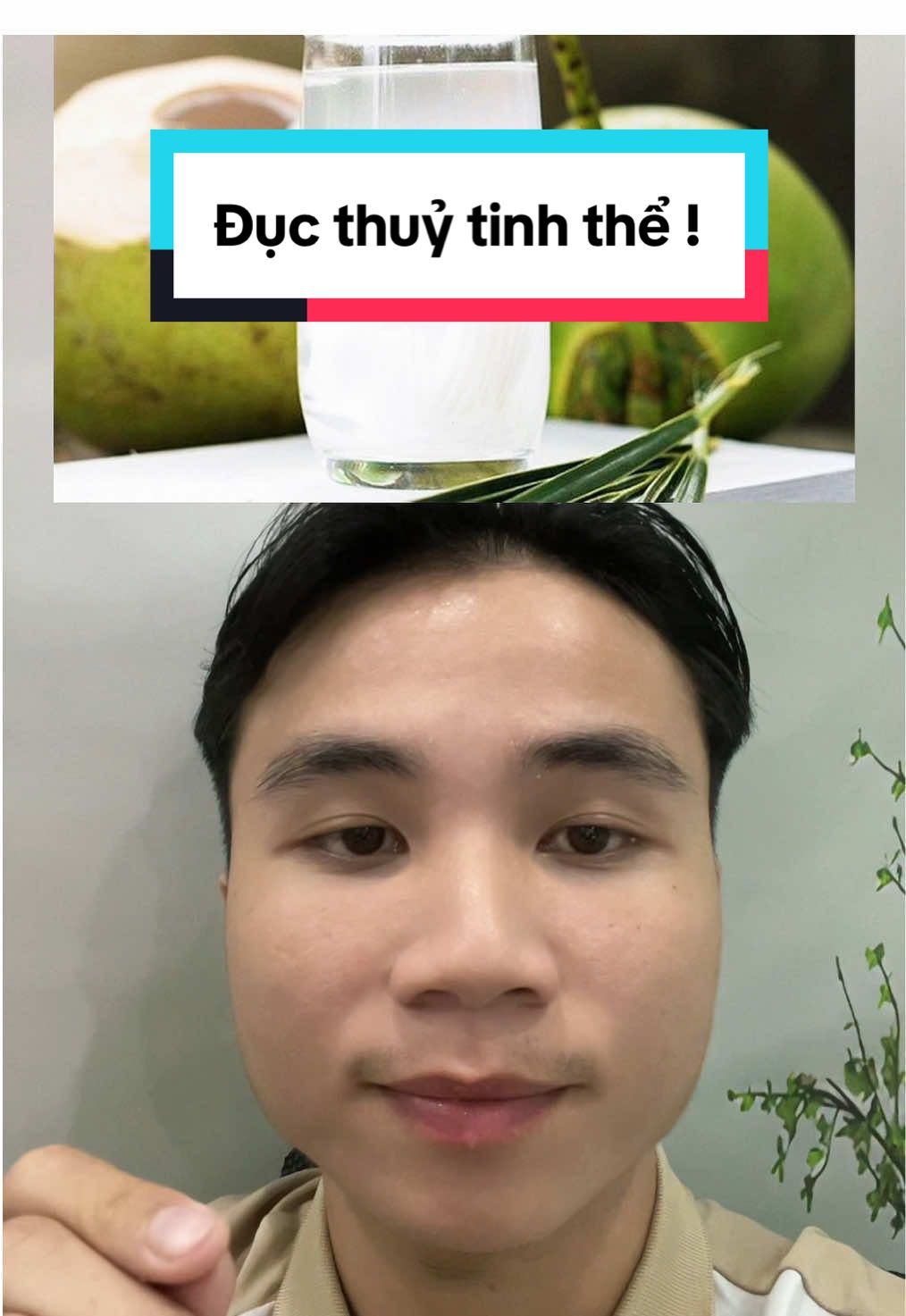 Đục thuỷ tinh thể ! #xuhuong2024 #ducthuytinhthe #chualanh #bacsitotnhat #suckhoe #yte #nuocdua #baithuocdangian 