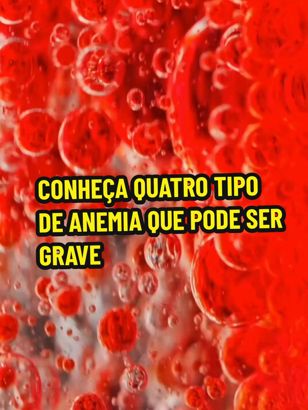 CONHEÇA QUATRO TIPO DE ANEMIA QUE PODE SER GRAVE.