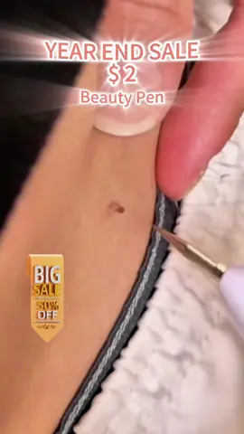 I was able to reduce my milia skin tags and awards with this one beauty tool #beautyhack #skincarehack #skin #face #beauty #yearendsale2024 #yearendsale 