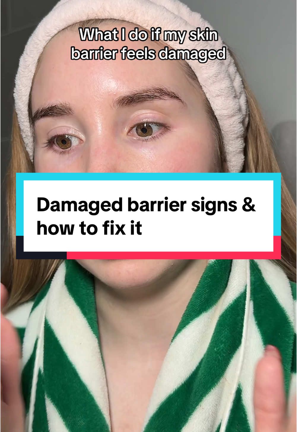 The background redness is just erythema from having just washed my face. If you have been ignoring the signs of a damaged barrier for a long time, you will need longer than 3-4 days to recuperate optimal skin barrier health. #skinbarrier #damagedskinbarrier #sensitiveskin #redness #rosacea